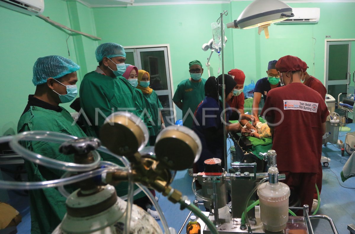 Operasi bibir sumbing gratis HUT Bhayangkara di Aceh Barat