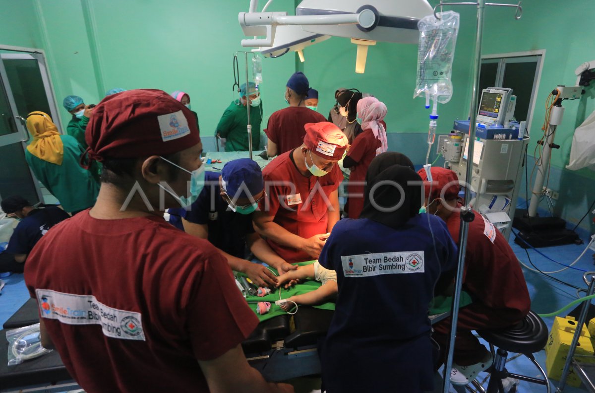 Operasi bibir sumbing gratis HUT Bhayangkara di Aceh Barat
