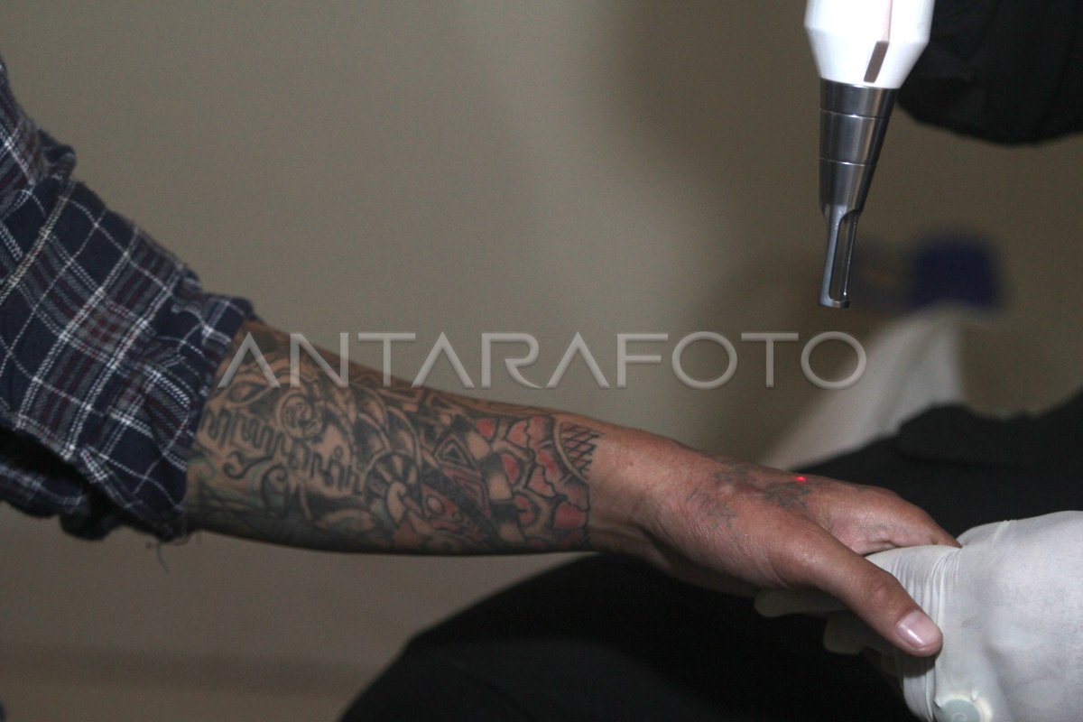 HAPUS TATO GRATIS ANTARA Foto
