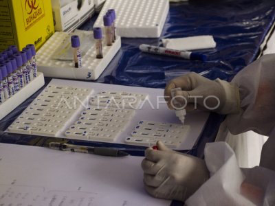 RAPID TEST COVID-19 DI BANDUNG