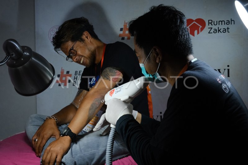 PROGRAM HAPUS TATO GRATIS ANTARA Foto