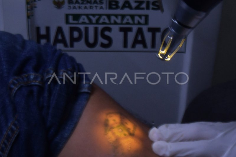 HAPUS TATO GRATIS ANTARA Foto